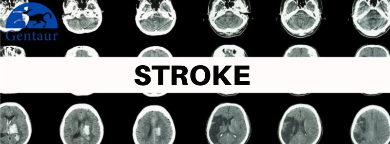 Stroke